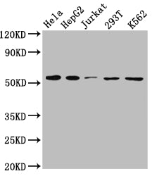 Western Blot | Positive WB detected in: Hela whole cell lysate, HepG2 whole cell lysate, Jurkat whole cell lysate, 293T whole cell lysate, K562 whole cell lysate | All lanes: MCT1 antibody at 1:1000 | Secondary | Goat polyclonal to rabbit IgG at 1/50000 dilution | Predicted band size: 54, 47 kDa | Observed band size: 54 kDa