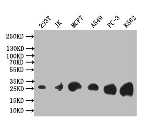 Western Blot | Positive WB detected in: 293T whole cell lysate, JK whole cell lysate, MCF7 whole cell lysate, A549 whole cell lysate, PC-3 whole cell lysate, K562 whole cell lysate | All lanes: Thymidine Kinase 1 antibody at 1:1000 | Secondary | Goat polyclonal to rabbit IgG at 1/50000 dilution | Predicted band size: 26 kDa | Observed band size: 26 kDa