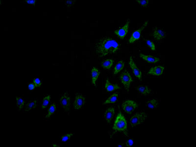 Immunofluorescence staining of Hela cell with ACAA2 Recombinant Monoclonal Antibody at 1:50, counter-stained with DAPI. The cells were fixed in 4% formaldehyde and blocked in 10% normal Goat Serum. The cells were then incubated with the antibody overnight at 4°C. The secondary antibody was Alexa Fluor 570-congugated AffiniPure Goat Anti-Rabbit IgG(H+L).