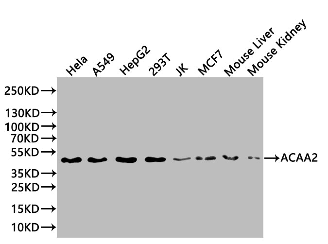 Western Blot | Positive WB detected in: MCF-7 whole cell lysate, A549 whole cell lysate, Mouse thymus | All lanes: ACAA2 antibody at 1:2000 | Secondary | Goat polyclonal to rabbit IgG at 1/50000 dilution | Predicted band size: 42 kDa | Observed band size: 42 kDa