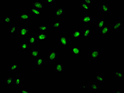 Immunofluorescence staining of Hela Cells with SYNCRIP Recombinant Monoclonal Antibody at 1:50, counter-stained with DAPI. The cells were fixed in 4% formaldehyde, permeated by 0.2% TritonX-100, and blocked in 10% normal Goat Serum. The cells were then incubated with the antibody overnight at 4℃. Nuclear DNA was labeled in blue with DAPI. The secondary antibody was FITC-conjugated AffiniPure Goat Anti-Rabbit IgG (H+L).