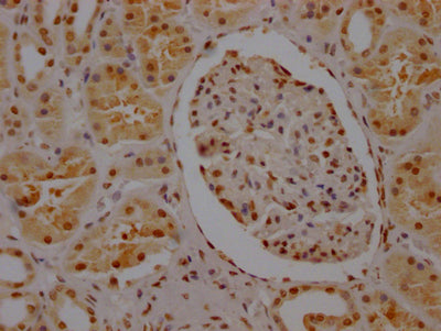 IHC image of the antibody diluted at 1:100 and staining in paraffin-embedded human kidney tissue performed on a Leica BondTM system. After dewaxing and hydration, antigen retrieval was mediated by high pressure in a citrate buffer (pH 6.0). Section was blocked with 10% normal goat serum 30min at RT. Then primary antibody (1% BSA) was incubated at 4℃ overnight. The primary is detected by a Goat anti-rabbit IgG polymer labeled by HRP and visualized using 0.05% DAB.