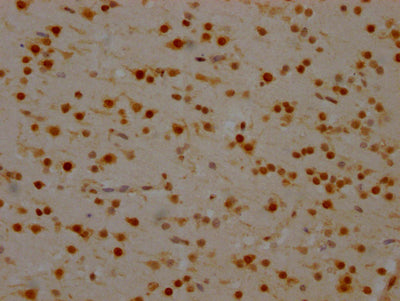 IHC image of SYNCRIP Recombinant Monoclonal Antibody diluted at 1:100 and staining in paraffin-embedded human brain tissue performed on a Leica BondTM system. After dewaxing and hydration, antigen retrieval was mediated by high pressure in a citrate buffer (pH 6.0). Section was blocked with 10% normal goat serum 30min at RT. Then primary antibody (1% BSA) was incubated at 4℃ overnight. The primary is detected by a Goat anti-rabbit IgG polymer labeled by HRP and visualized using 0.05% DAB.