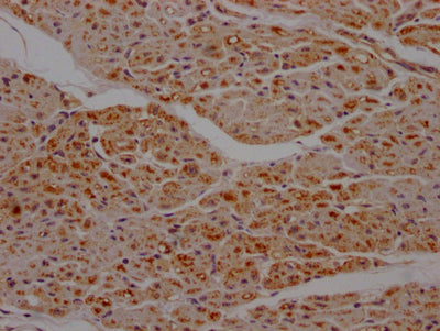 IHC image of SDHB Recombinant Monoclonal Antibody diluted at 1:100 and staining in paraffin-embedded human heart tissue performed on a Leica BondTM system. After dewaxing and hydration, antigen retrieval was mediated by high pressure in a citrate buffer (pH 6.0). Section was blocked with 10% normal goat serum 30min at RT. Then primary antibody (1% BSA) was incubated at 4℃ overnight. The primary is detected by a Goat anti-rabbit IgG polymer labeled by HRP and visualized using 0.05% DAB.