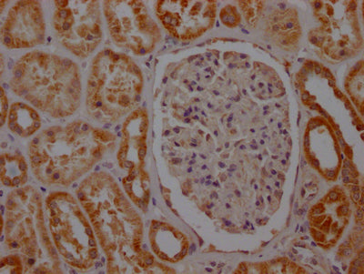 IHC image of SDHB Recombinant Monoclonal Antibody diluted at 1:100 and staining in paraffin-embedded human kidney tissue performed on a Leica BondTM system. After dewaxing and hydration, antigen retrieval was mediated by high pressure in a citrate buffer (pH 6.0). Section was blocked with 10% normal goat serum 30min at RT. Then primary antibody (1% BSA) was incubated at 4℃ overnight. The primary is detected by a Goat anti-rabbit IgG polymer labeled by HRP and visualized using 0.05% DAB.