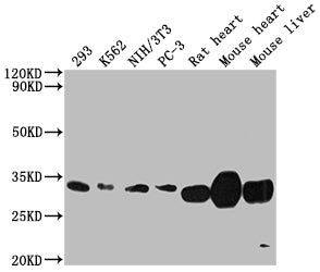 Western Blot | Positive WB detected in: 293 whole cell lysate, K562 whole cell lysate, NIH/3T3 whole cell lysate, PC-3 whole cell lysate, Rat heart tissue, Mouse heart tissue, Mouse liver tissue | All lanes: SDHB antibody at 1:2000 | Secondary | Goat polyclonal to rabbit IgG at 1/50000 dilution | Predicted band size: 32 kDa | Observed band size: 32 kDa