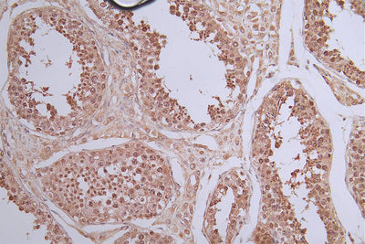 IHC image of the antibody diluted at 1:50 and staining in paraffin-embedded human testis tissue performed on a Leica BondTM system. After dewaxing and hydration, antigen retrieval was mediated by high pressure in a citrate buffer (pH 6.0). Section was blocked with 10% normal goat serum 30min at RT. Then primary antibody (1% BSA) was incubated at 4°C overnight. The primary is detected by a Goat anti-rabbit polymer IgG labeled by HRP and visualized using 0.40% DAB.