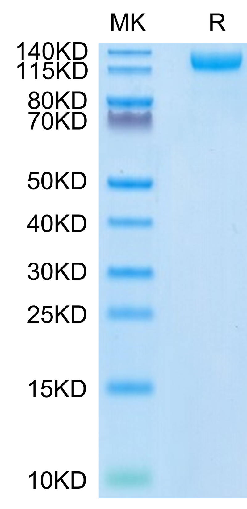 SARS-COV-2 Spike S1 (N501Y) on Tris-Bis PAGE under reduced condition. The purity is greater than 95%.