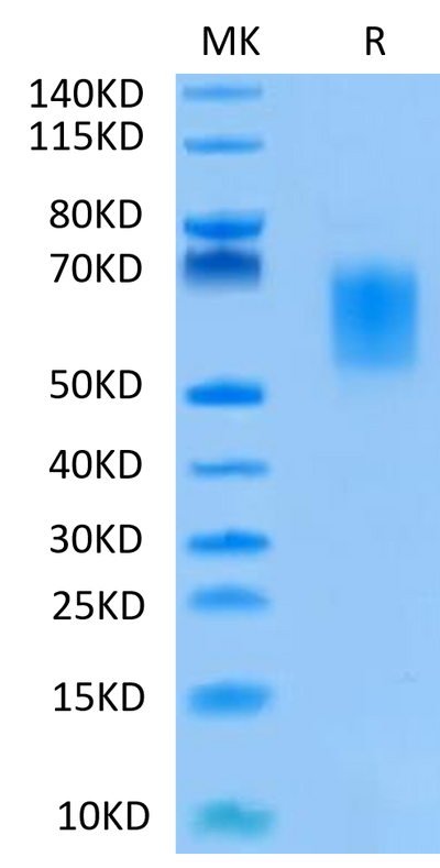 Human B7-H2 on Tris-Bis PAGE under reduced condition. The purity is greater than 95%.