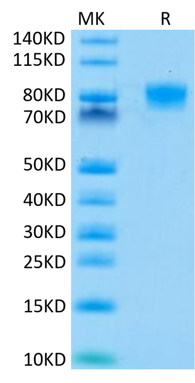 Human B7-H2 on Tris-Bis PAGE under reduced condition. The purity is greater than 95%.