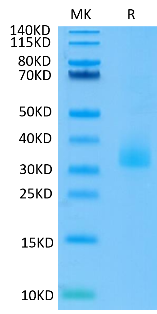 Human ANGPTL3 on Tris-Bis PAGE under reduced conditions. The purity is greater than 95%.