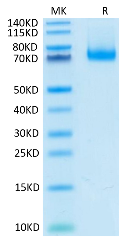 Mouse PD-L1 on Tris-Bis PAGE under reduced condition. The purity is greater than 95%.