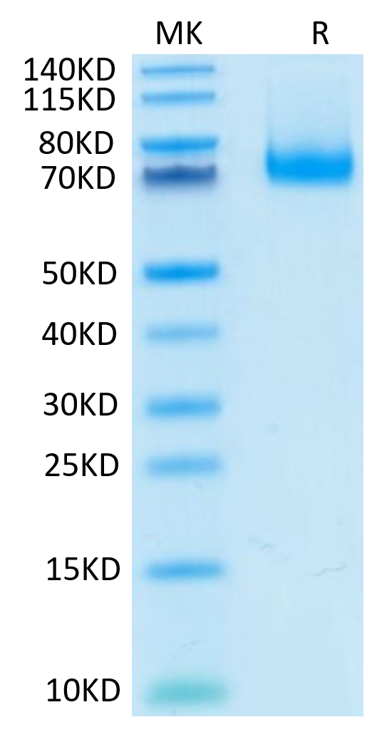 Mouse PD-L1 on Tris-Bis PAGE under reduced condition. The purity is greater than 95%.