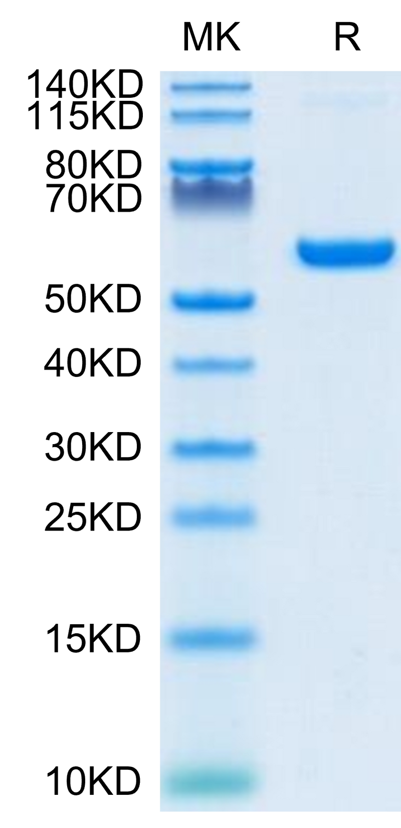 SARS-COV-2 Spike RBD on Tris-Bis PAGE under reduced condition. The purity is greater than 95%.