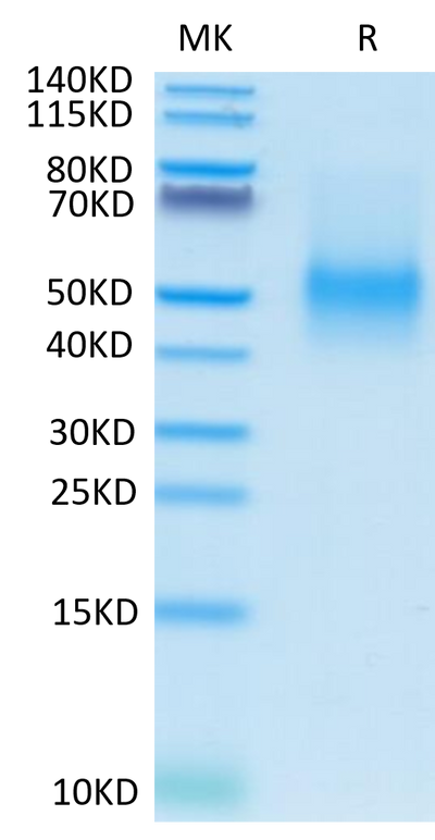 Mouse PD-L1 on Tris-Bis PAGE under reduced condition. The purity is greater than 95%.