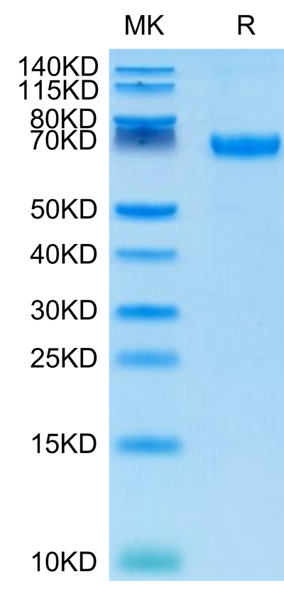 Cynomolgus PD-L1 on Tris-Bis PAGE under reduced conditions. The purity is greater than 95%.