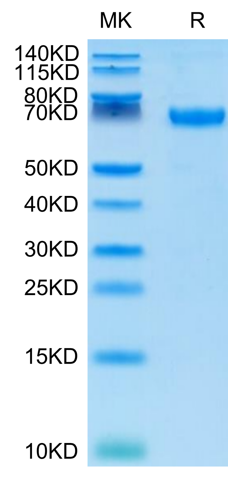 Cynomolgus PD-L1 on Tris-Bis PAGE under reduced conditions. The purity is greater than 95%.