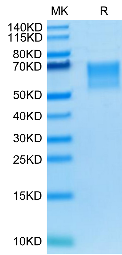 Human TPBG on Tris-Bis PAGE under reduced condition. The purity is greater than 95%.