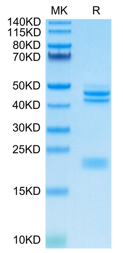 Cynomolgus IL-23 alpha&Mouse IL-12 beta on Tris-Bis PAGE under reduced condition. The purity is greater than 95%.