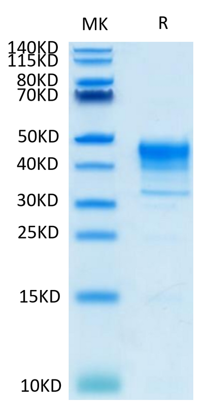 Biotinylated Cynomolgus MSLN on Tris-Bis PAGE under reduced condition. The purity is greater than 95%.