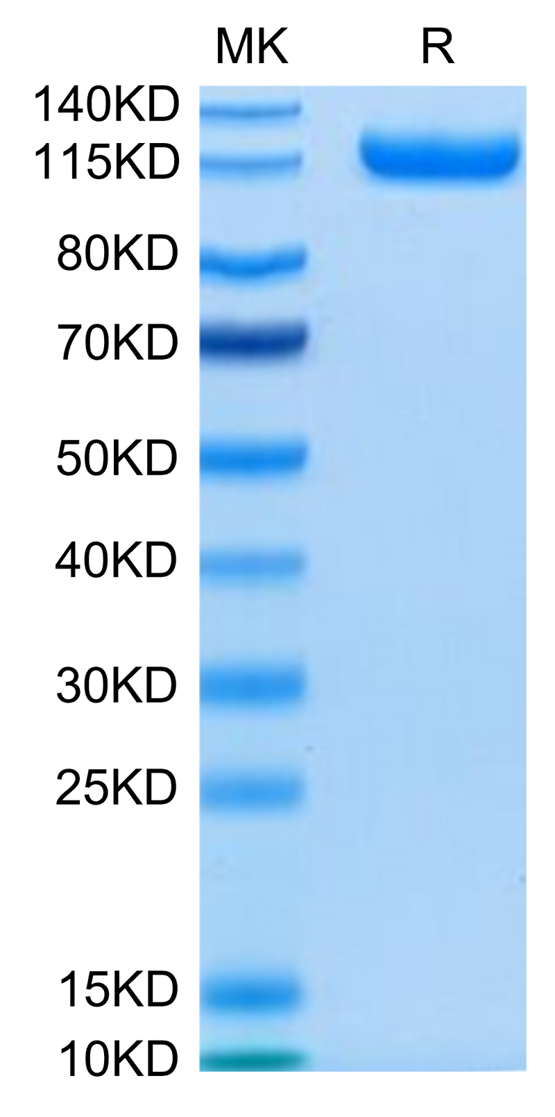 Human CDCP1 on Tris-Bis PAGE under reduced condition. The purity is greater than 95%.