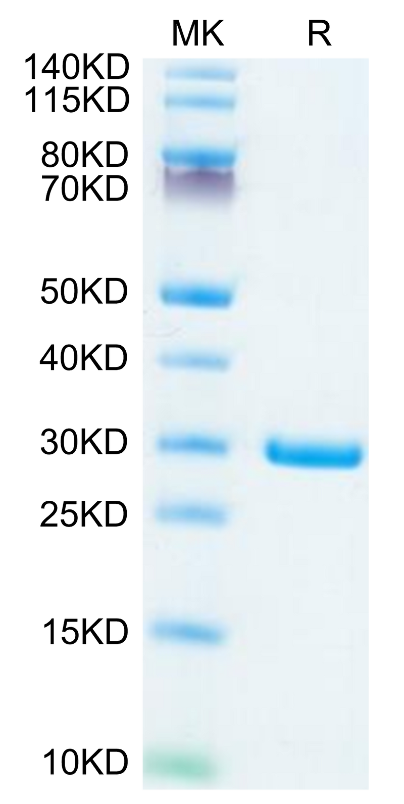 SARS-COV-2 NSP7&NSP8 on Tris-Bis PAGE under reduced condition. The purity is greater than 95%.