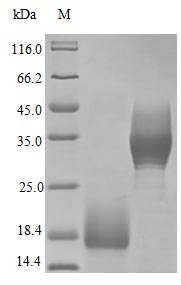 Recombinant Human Trefoil Factor 3 Protein (TFF3), Active