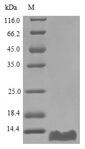 Recombinant Human C-C Motif Chemokine 20 Protein (CCL20), Active