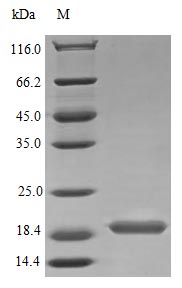 Recombinant Human Interleukin-17B Protein (IL17B), Active