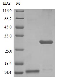 Recombinant Human Interleukin-17A Protein (IL17A)