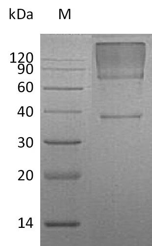 Greater than 90% as determined by SDS-PAGE.