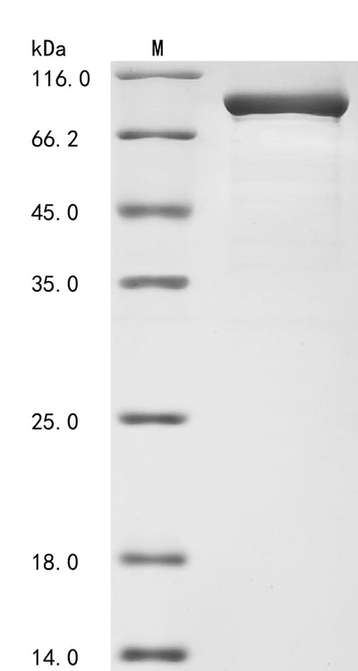 Greater than 85% as determined by SDS-PAGE.