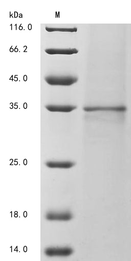 Greater than 85% as determined by SDS-PAGE.