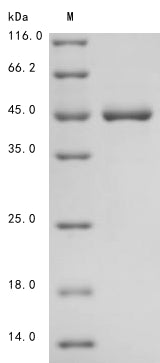 Greater than 85% as determined by SDS-PAGE.