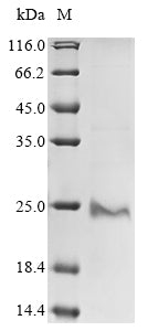 Greater than 85% as determined by SDS-PAGE.