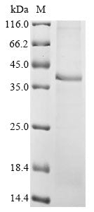 Greater than 85% as determined by SDS-PAGE.