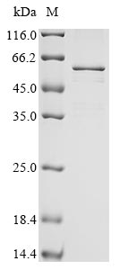 Greater than 85% as determined by SDS-PAGE.