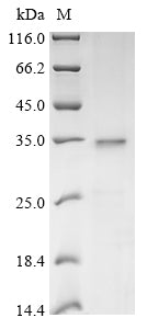 Greater than 85% as determined by SDS-PAGE.