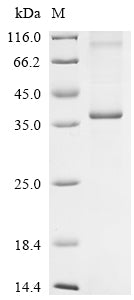 Greater than 85% as determined by SDS-PAGE.