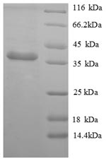 Greater than 90% as determined by SDS-PAGE.