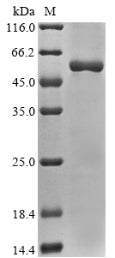 Greater than 85% as determined by SDS-PAGE.