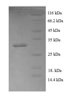 Greater than 90% as determined by SDS-PAGE.