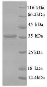 Greater than 90% as determined by SDS-PAGE.