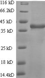 Greater than 90% as determined by SDS-PAGE.