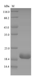 Greater than 90% as determined by SDS-PAGE.