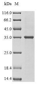 Greater than 85% as determined by SDS-PAGE.