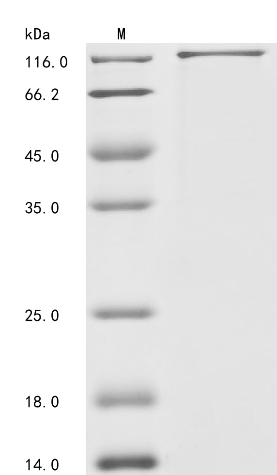 Greater than 85% as determined by SDS-PAGE.