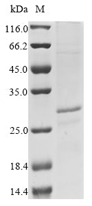 Greater than 85% as determined by SDS-PAGE.