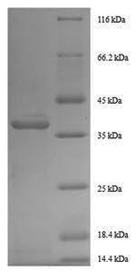 Greater than 90% as determined by SDS-PAGE.