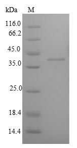 Greater than 90% as determined by SDS-PAGE.